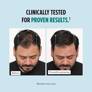 Nutrafol Men's Hair Growth Supplement